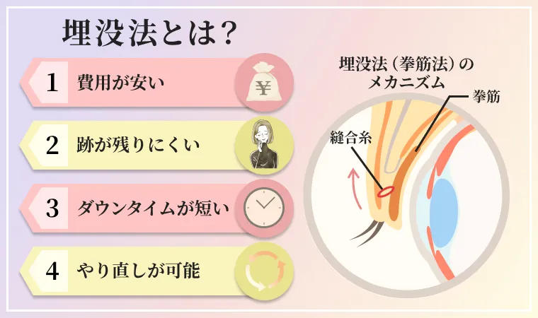 埋没法とは？費用が安いことや跡が残りにくいこと、ダウンタイムが短いこと、やり直しが可能なことがメリットの二重整形術です。