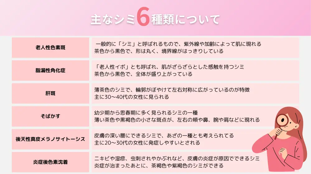 シミの種類と特徴