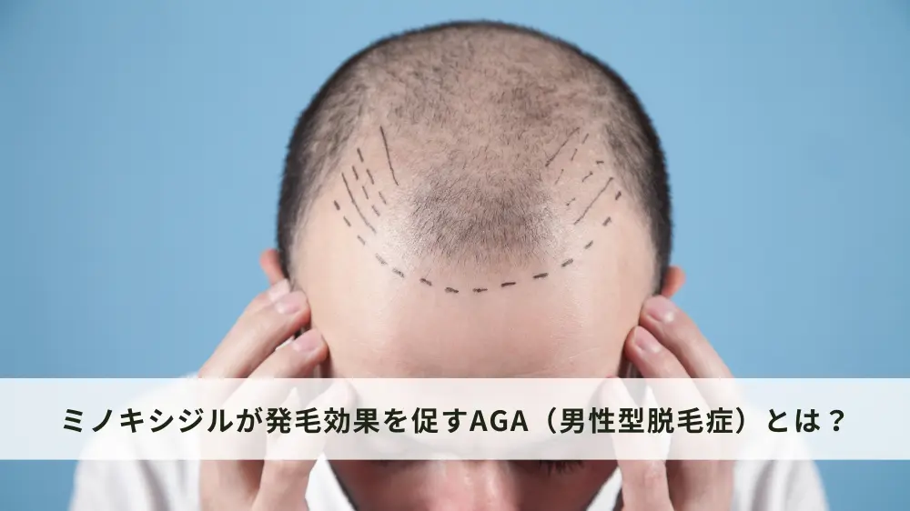 無毛症 