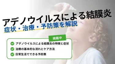 アデノウイルス 結膜炎