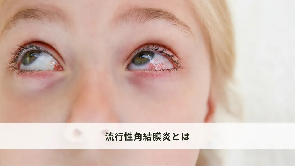 流行性角結膜炎とは