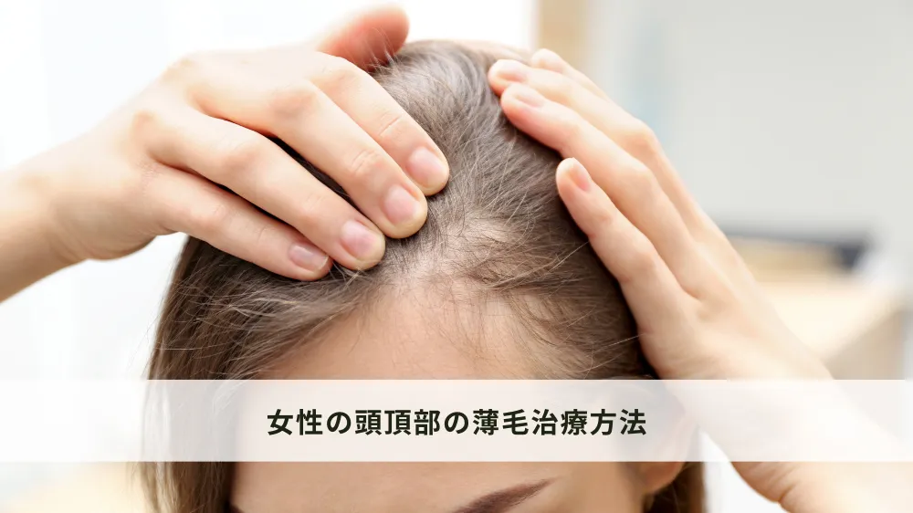 女性の頭頂部の薄毛治療方法