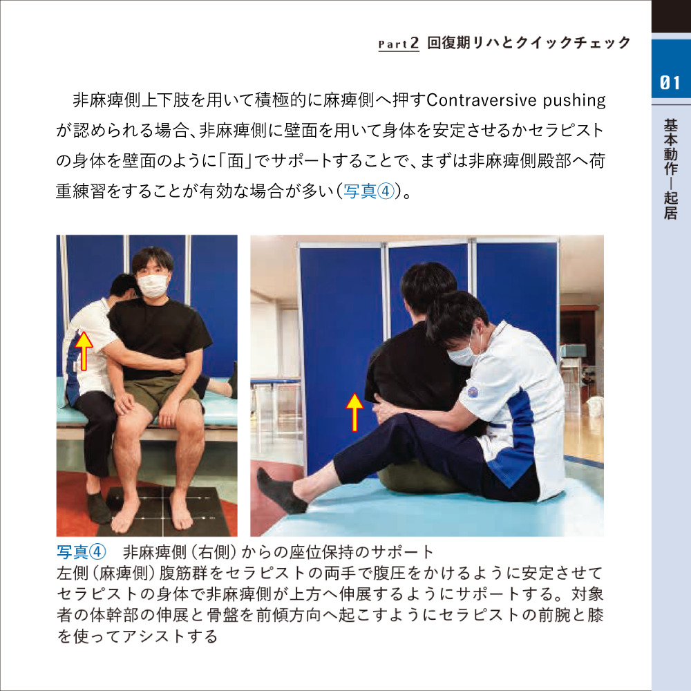 片麻痺者にみられる背臥位での状態と典型的な寝返りの例