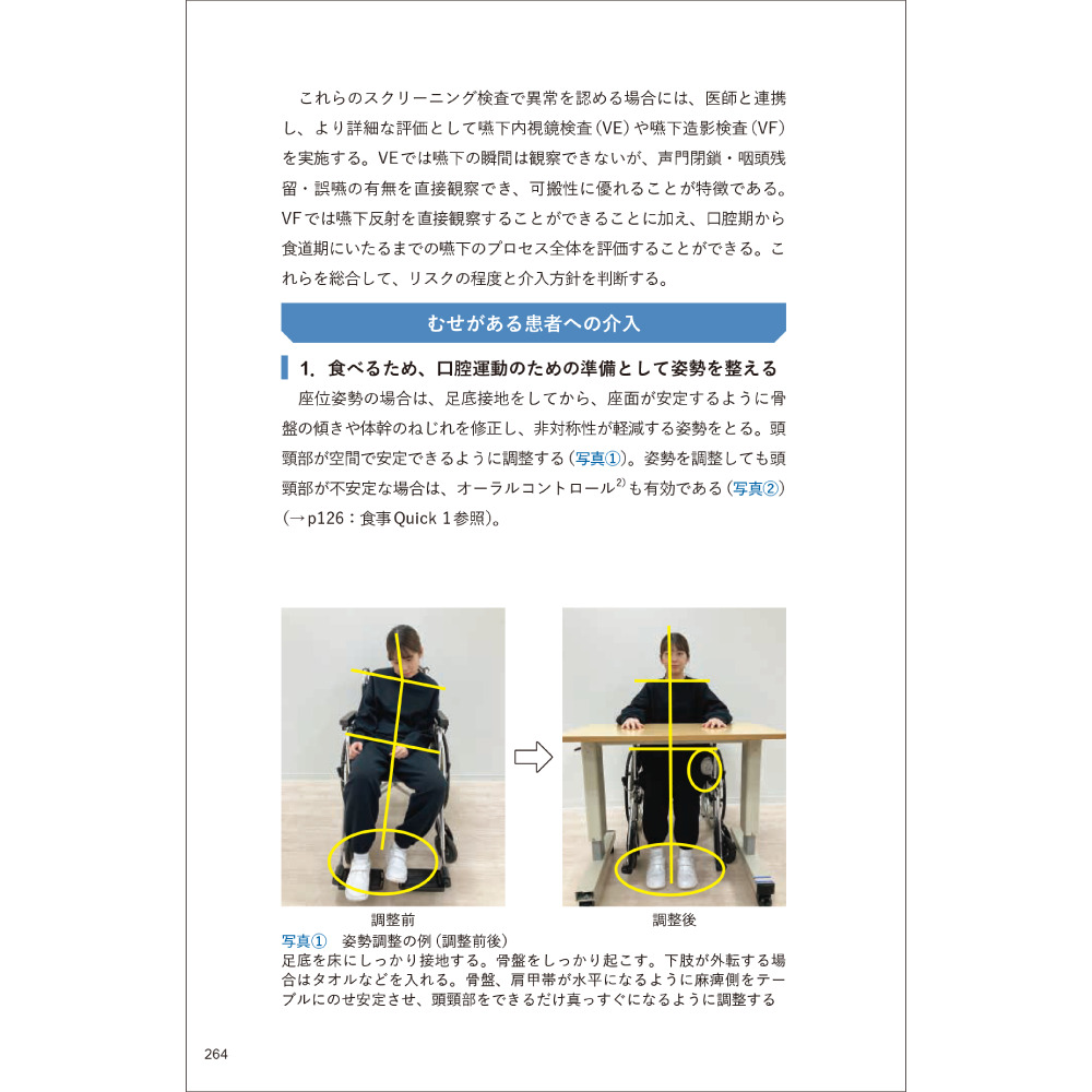 立ち上がれない症例への介入 高座位からの立ち上がり運動