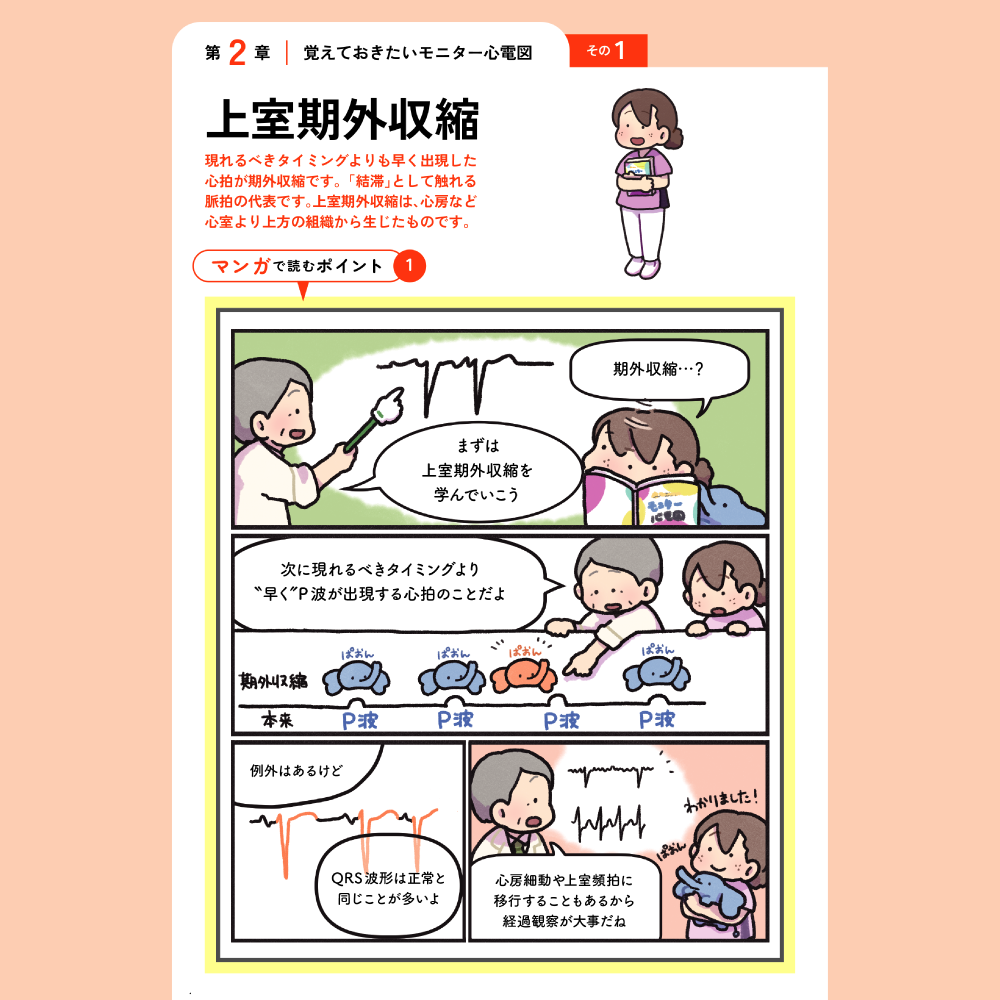 今さら聞けないモニター心電図 第2章 覚えておきたいモニター心電図