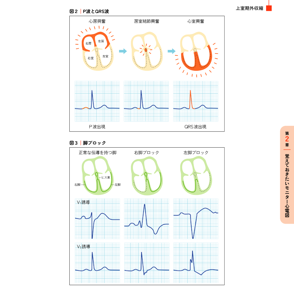 今さら聞けないモニター心電図 第2章 覚えておきたいモニター心電図