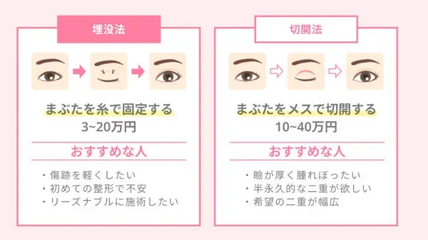 埋没法と切開法の違い