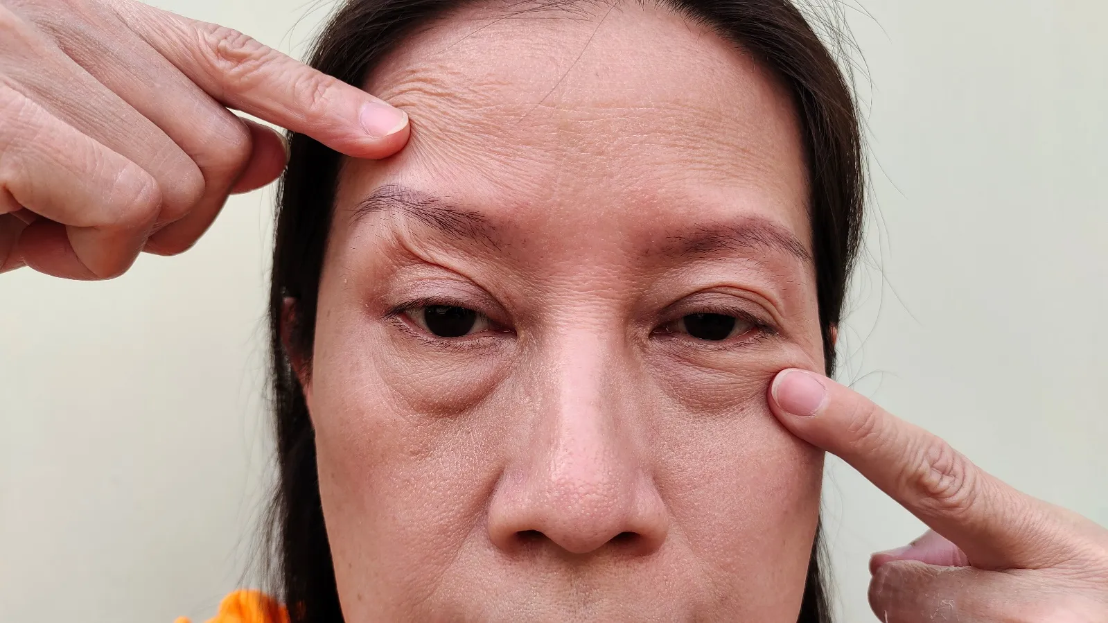 目元ハイフの仕組み