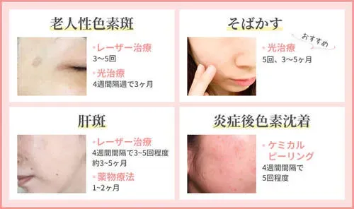 おすすめクリニック