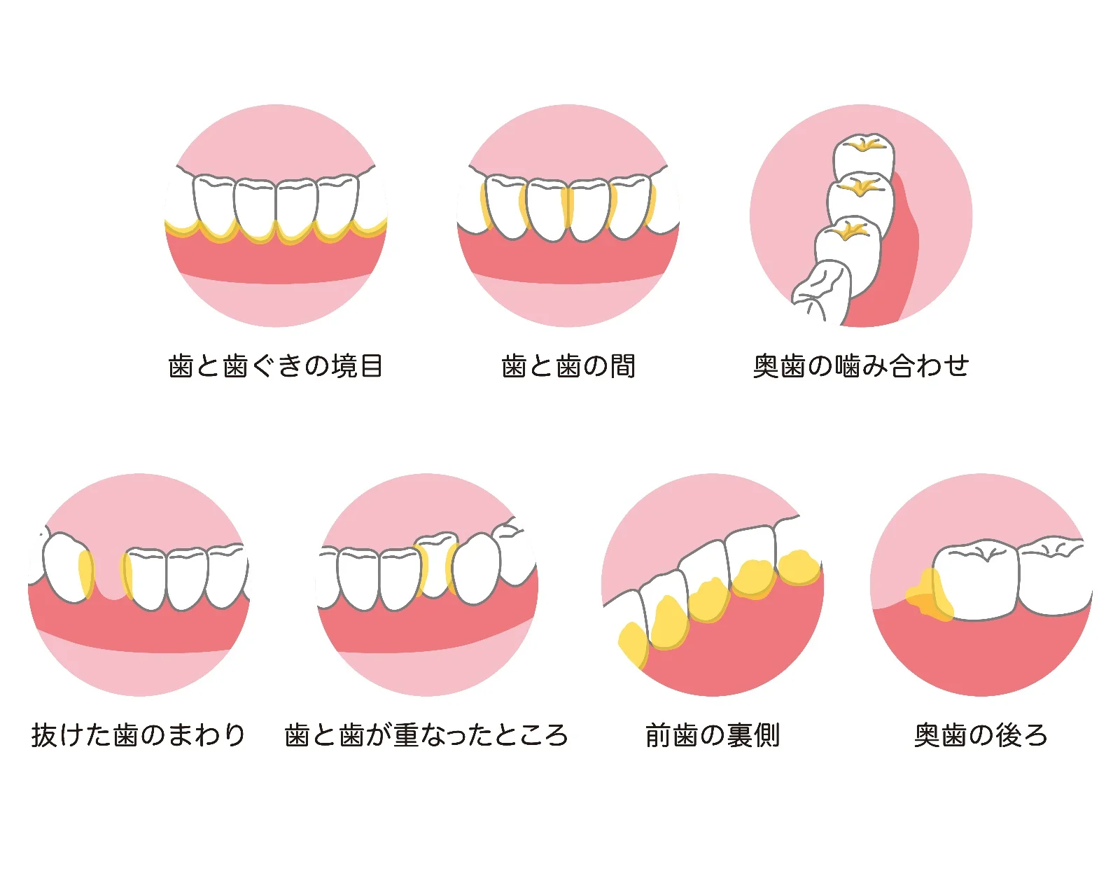 汚れが残りやすい5つの場所