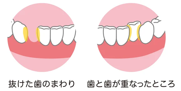 歯と歯ぐきの境目の磨き方