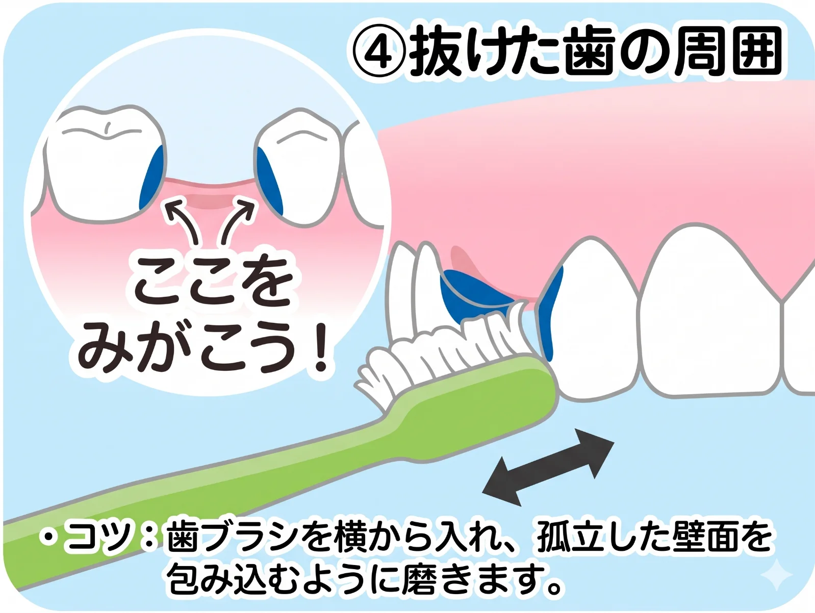 高齢者特有の歯のトラブルへの対応