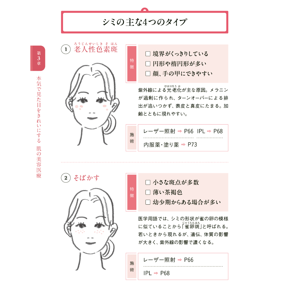 美しさは、再生する。 第3章 本気で見た目をきれいにする 肌の美容医療 シミの主な4つのタイプ