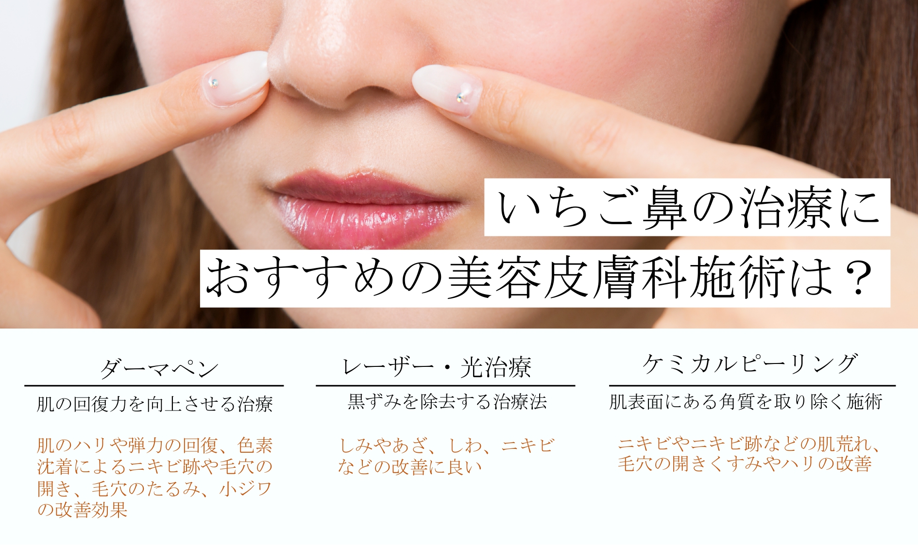 いちご鼻の治療におすすめの美容皮膚科施術は?