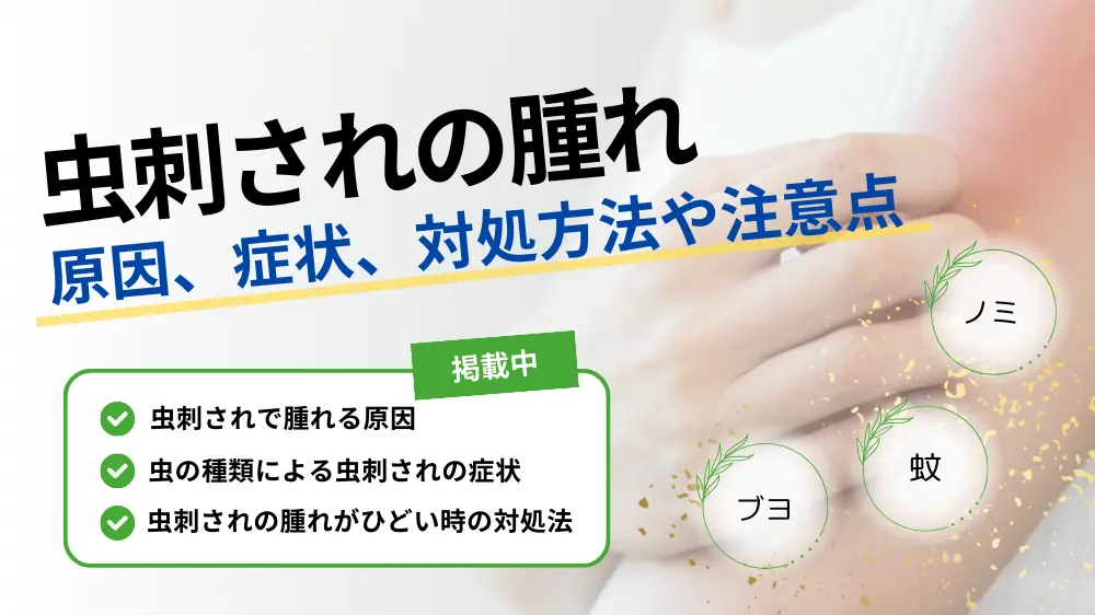 虫刺され 腫れる