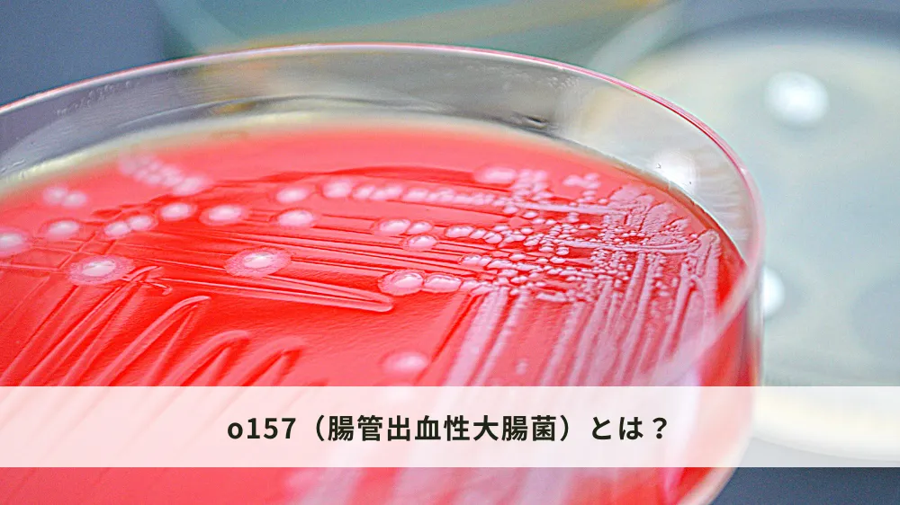 o157（腸管出血性大腸菌）とは？
